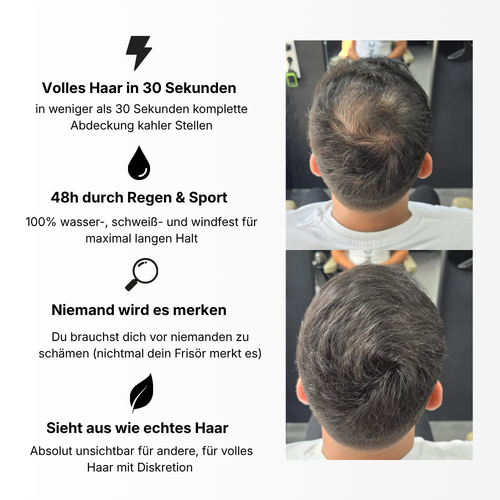 Hairfiller™ für volles Haar in 30 Sekunden