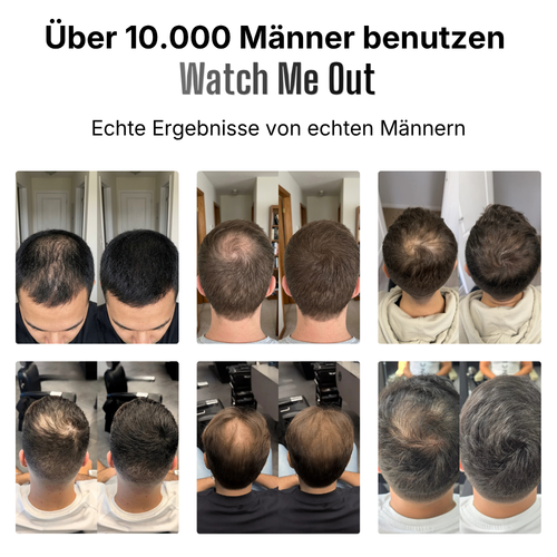 Hairfiller™ für volles Haar in 30 Sekunden